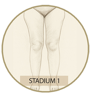 stadion1 Stadion 1