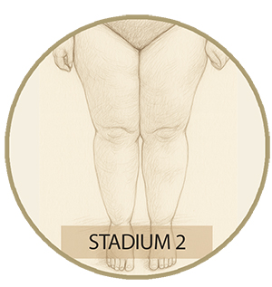 stadion2 Stadion 2