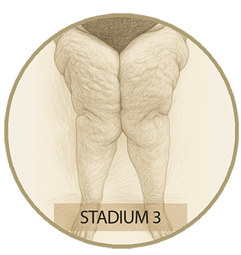 stadion3 Stadion 3